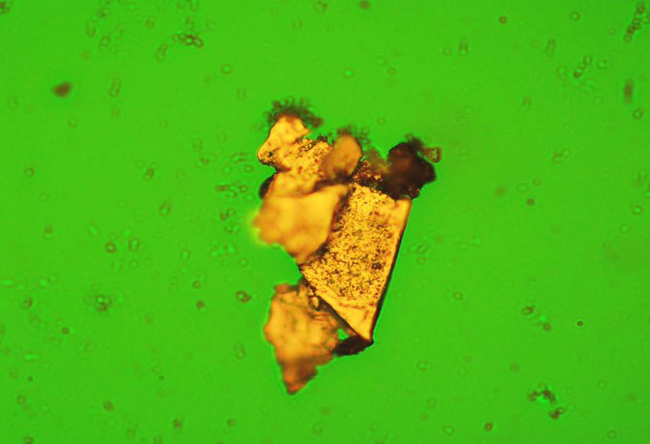 铁谱分析谱片显微图三